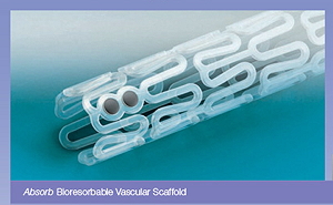 absorbierbarer Stent 